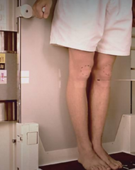 <p>Weightbearing Knees - AP Projection</p>