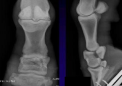 <p>What is the etiology of fractures at the second phalanx (short pastern)?</p>