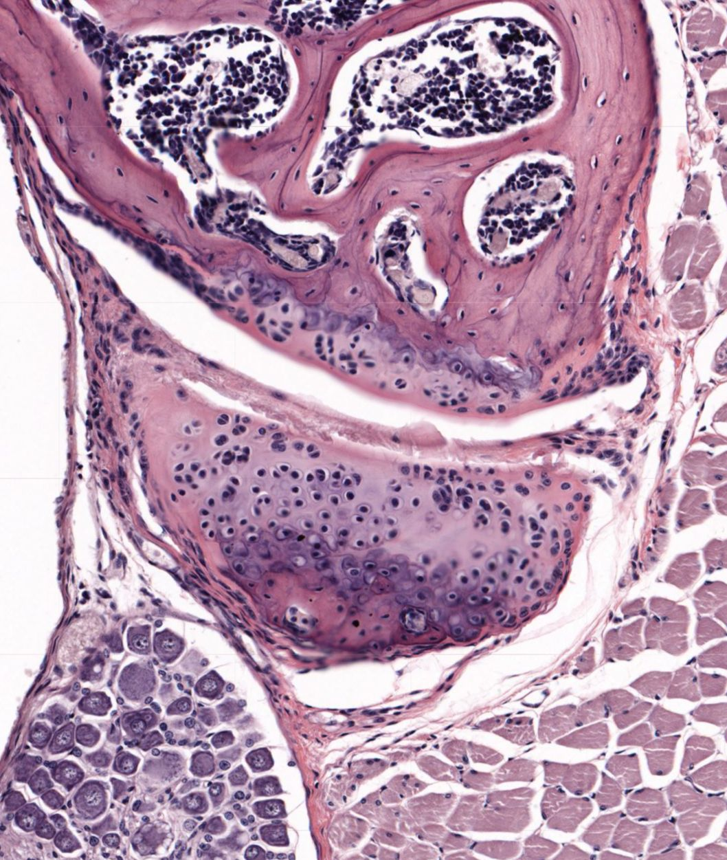 term image