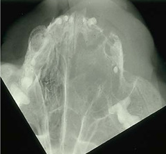 <p>Is this normal or abnormal?</p>