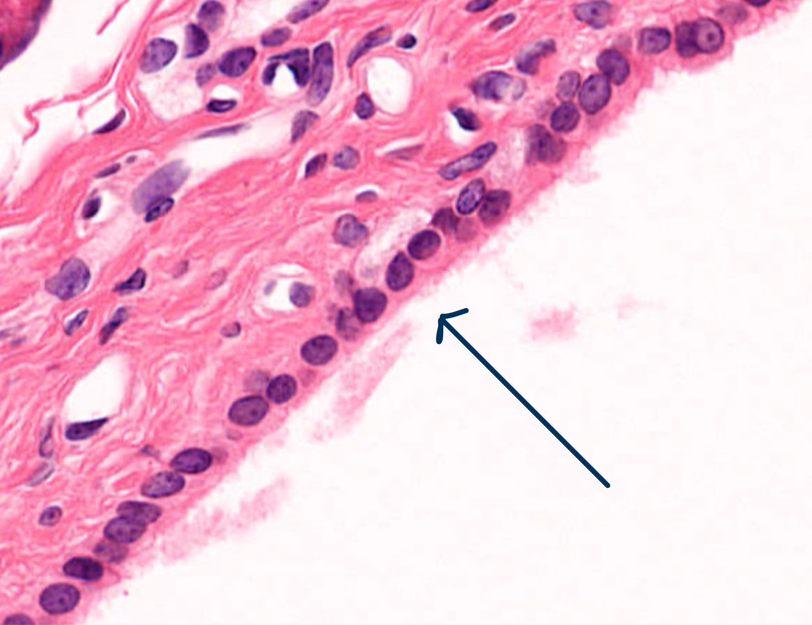 <p>tissue type</p>