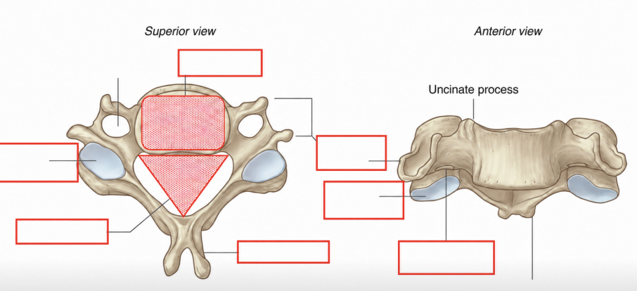 <p>Label each line (not just red box) on the vertebrae, and what kind is it?</p>