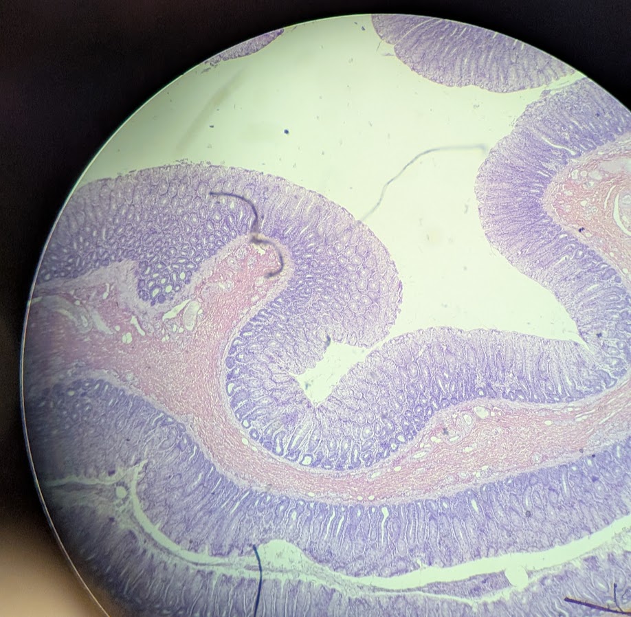 <p>Where in the body is this</p>