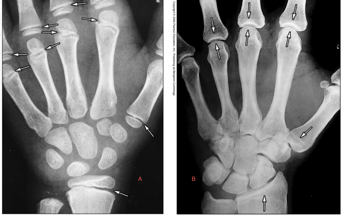 <p>Which is an adult, a or b?</p>