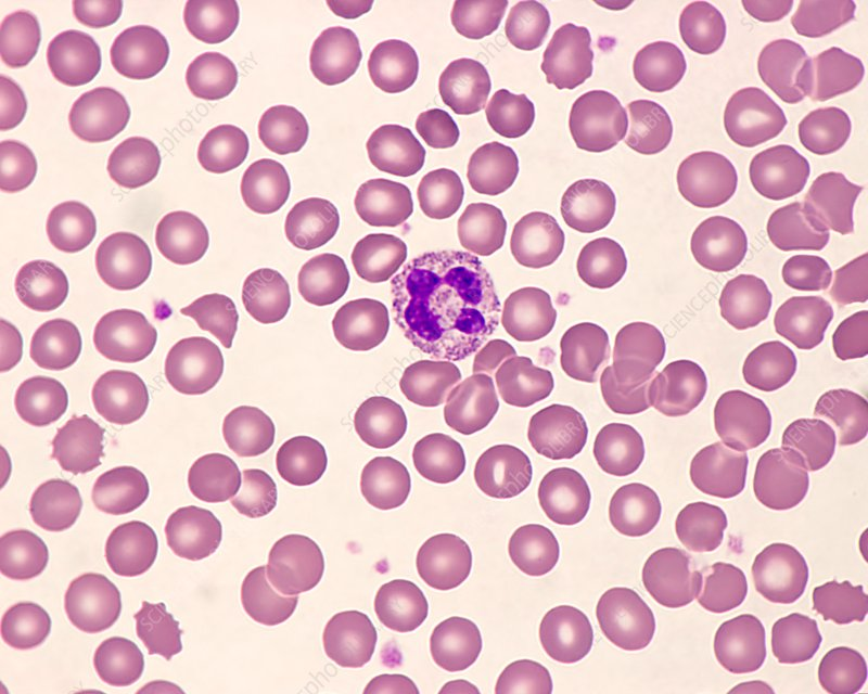 <p>granular, multilobed, phagocytic WBC</p><ul><li><p>most common: 50-70%</p></li><li><p>bacterial infection</p></li></ul><p></p>