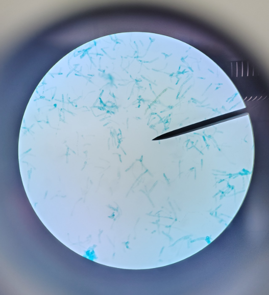 <ol><li><p>Name the phylum</p></li><li><p>Name it </p></li></ol><p></p>