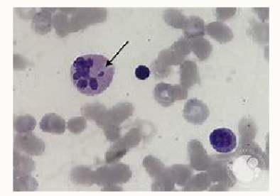 <ul><li><p>Barr body</p></li></ul><p></p>