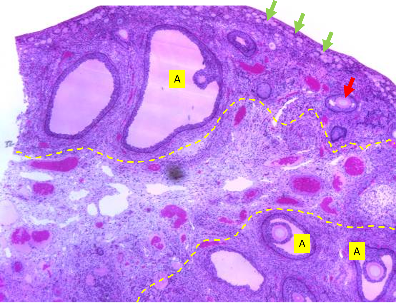 <p><span>The structures at the tip of the green arrows are ___</span></p><p><span> follicles</span></p><p><span>These are dormant.</span></p>