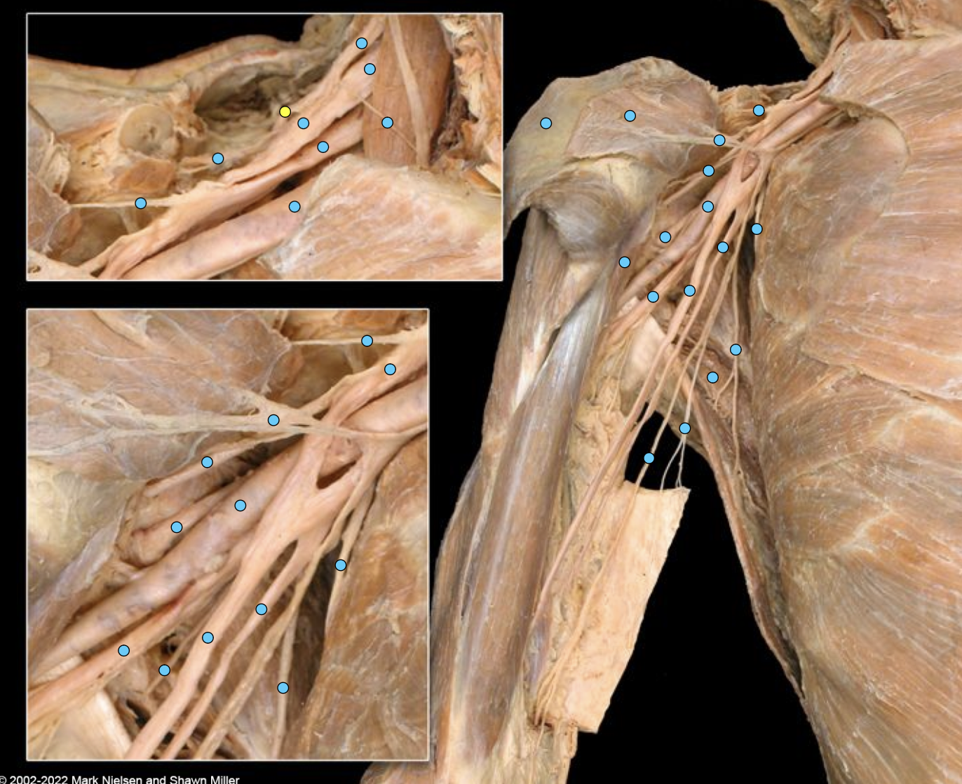 knowt flashcard image