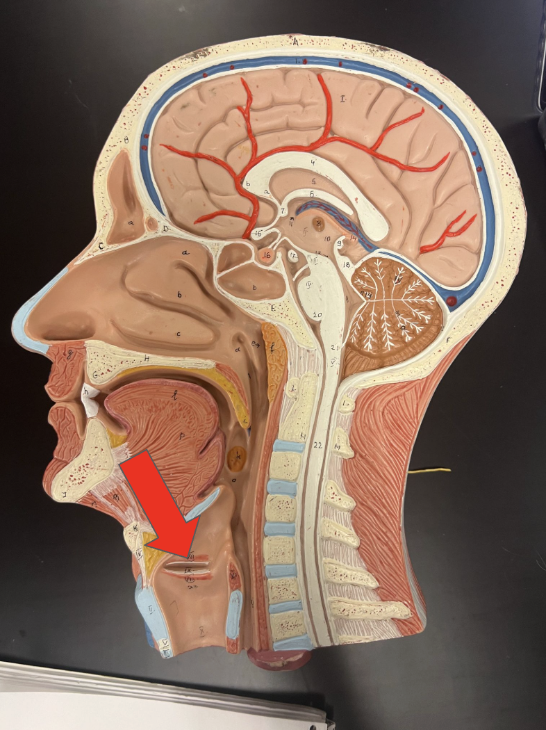 <p>This structure is the</p>
