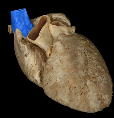 term image