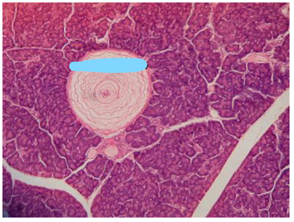 <p>What part of the pancreas (cat) is this </p>