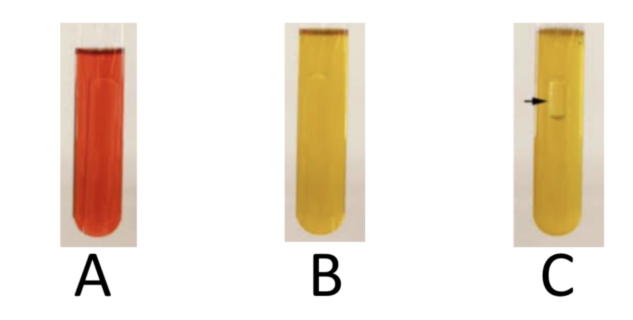 <p>Phenol Red Broth Sugar Fermenation</p><p>a) Medium?</p><p>b) Substrate?</p><p>c) Enzyme?</p><p>d) Indicator/Reagent?</p><p>e) End Product?</p>