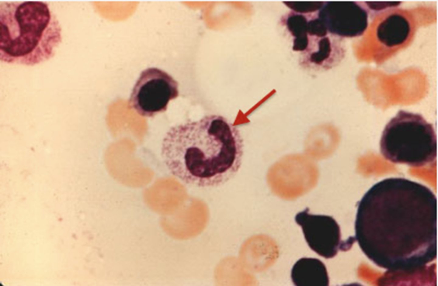 <p>Identify the DEVELOPING Cell</p>