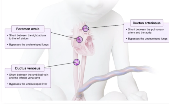 <p>A hole connecting the right and left atria, blood is allowed to flow from the right to the left atrium, the right ventricle wants to pump blood to the lungs but the fetal lungs are nonfunctional, so blood passing through this duct bypasses the pulmonary circulation </p>