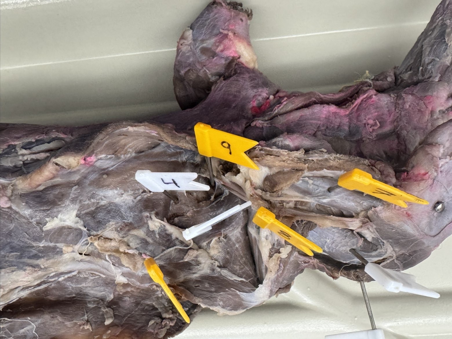 <p>Numbers:</p><p>4</p><p>7</p><p>9</p>