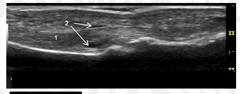 <p>Name 1 and 2.</p>