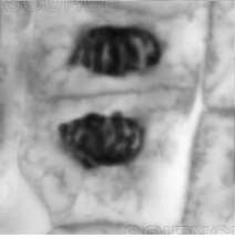 <p>what is this plant cell going through? </p>