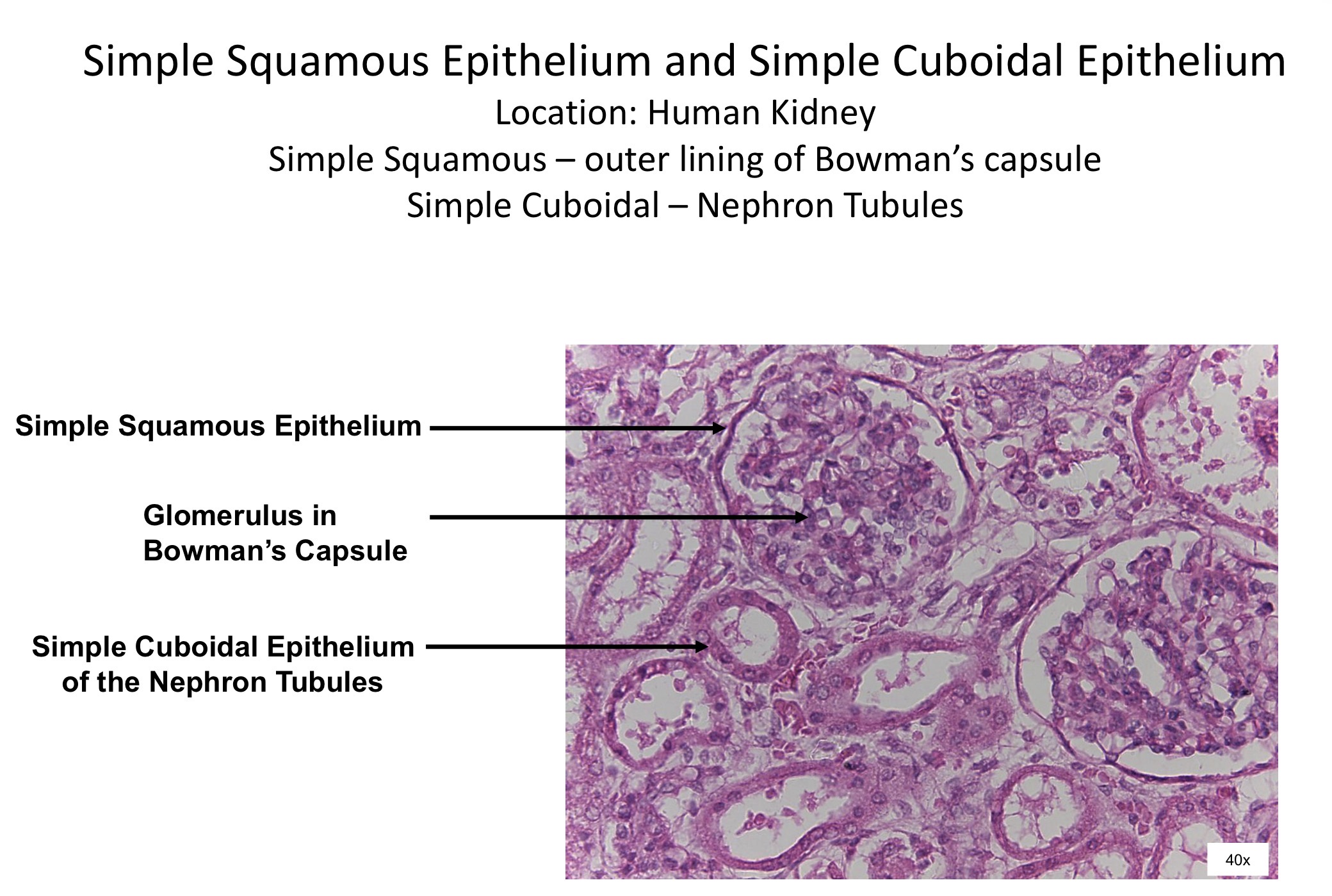 <ol><li><p>Simple squamous epithelium </p></li><li><p>Glomerulus in bowman’s capsule </p></li><li><p>Simple cuboidal epithelium of nephron tubules</p></li></ol><p></p>