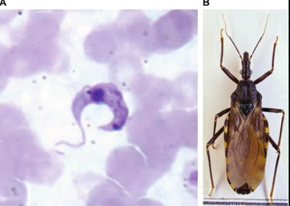 <p>Name the parasite-vector pair. What disease do they cause? How and where is it transmitted? What are the symptoms?</p>