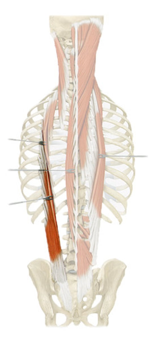 <p>posterior rami of spinal nerves</p>
