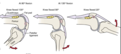 <p>When the leg is extended, how is the patella positioned?</p>