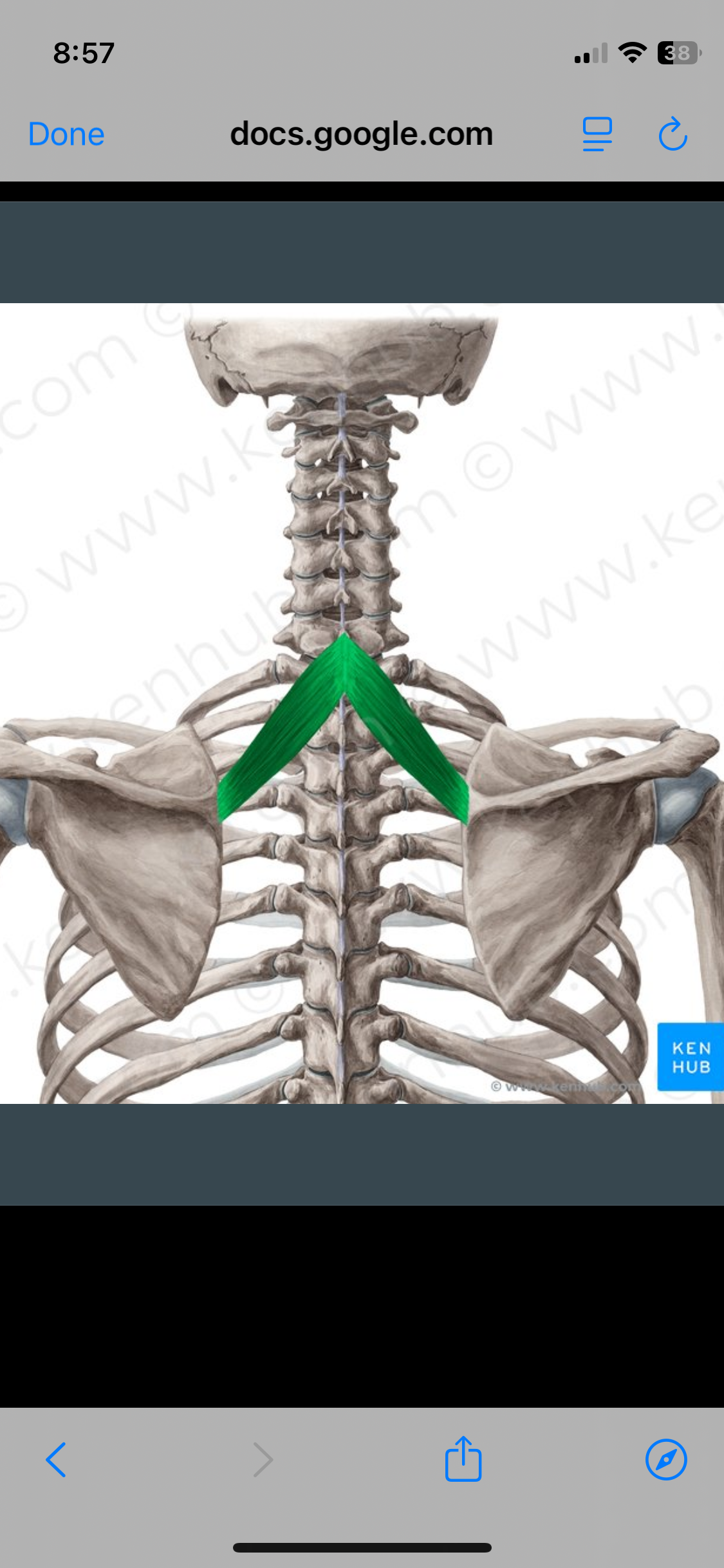 <p>Rhomboid Minor </p>