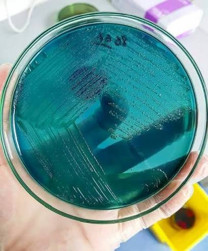 <p>Green, transparent, and usually smaller</p><p></p><p>No sugar fermentation; no H₂S production.</p>