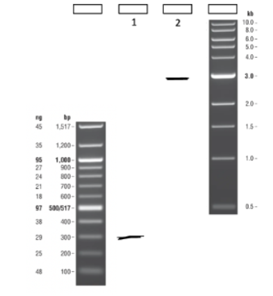 <p><span style="background-color: transparent;"><strong>Based on the gel below, what is the approximate fragment size of Sample 1?</strong></span></p><p><span style="background-color: transparent;">&nbsp;&nbsp;A) 29bp&nbsp;</span></p><p><span style="background-color: transparent;">&nbsp;&nbsp;B) 300bp&nbsp;</span></p><p><span style="background-color: transparent;">&nbsp;&nbsp;C) 3000bp&nbsp;</span></p><p><span style="background-color: transparent;">&nbsp;&nbsp;D) Cannot determine </span></p><p><span style="background-color: transparent;">(Lecture #7-8 Questions)</span></p>