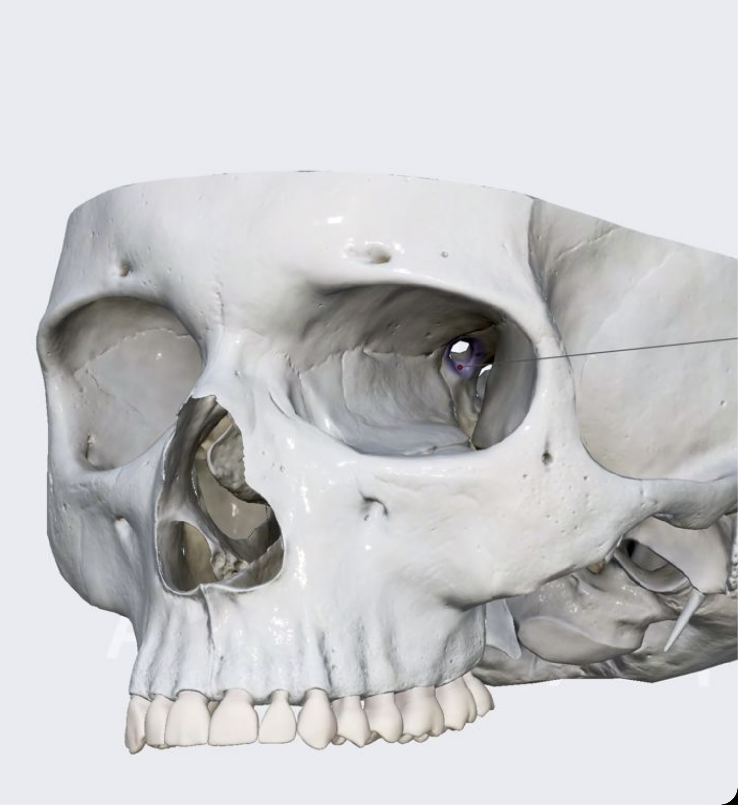 term image