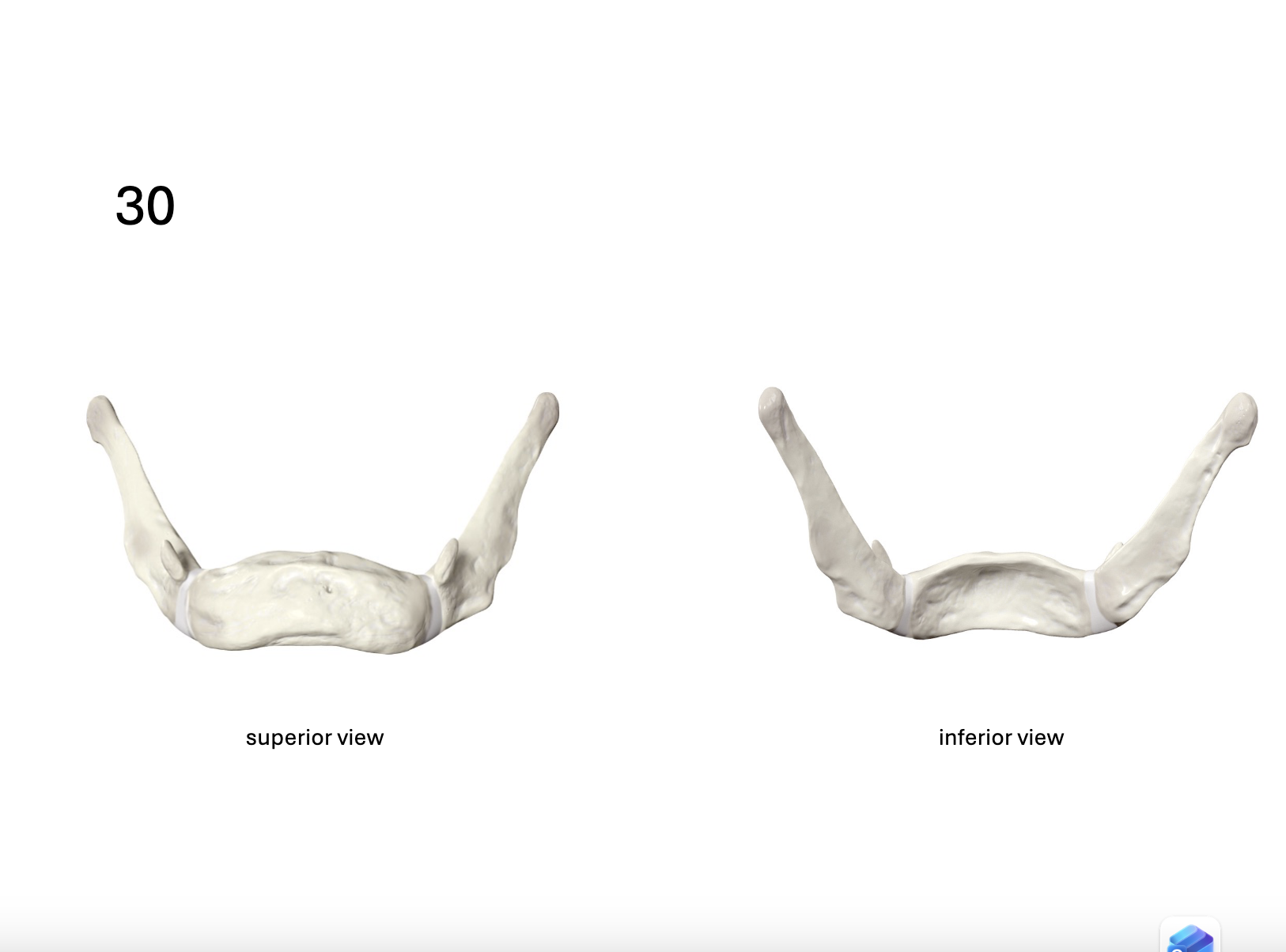 <p>Identify the <strong>bone</strong></p>