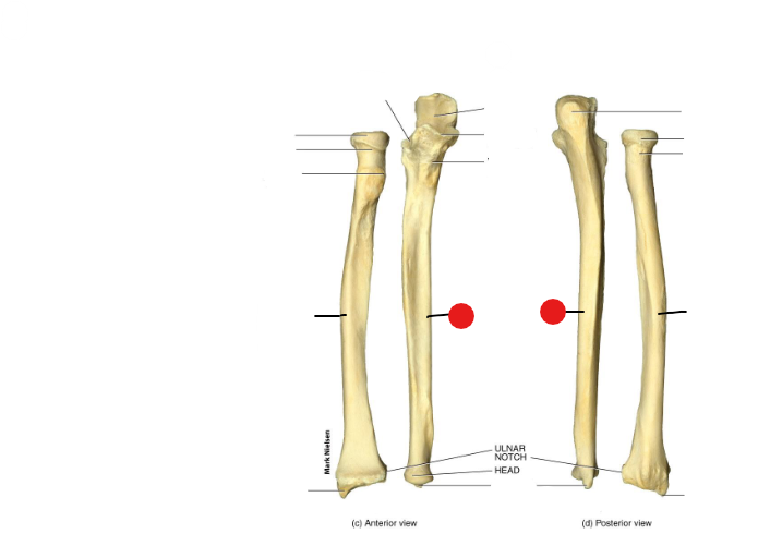 <p>Identify the structure pinned</p>
