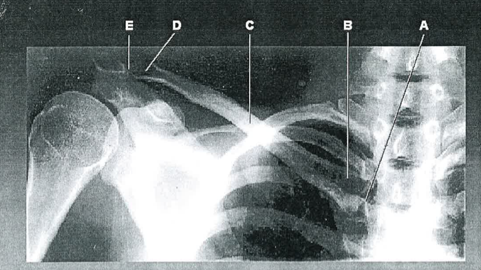 <p>D</p>