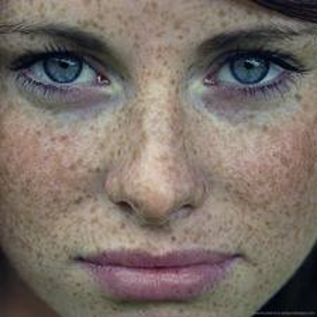 <p>freckle</p>