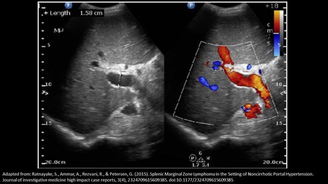 <p>Which of the following statements correctly, describes the findings on the image?</p>