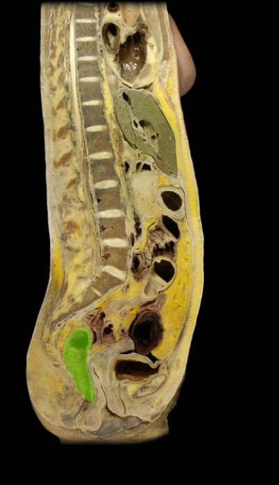<p><span>Rectum</span></p>