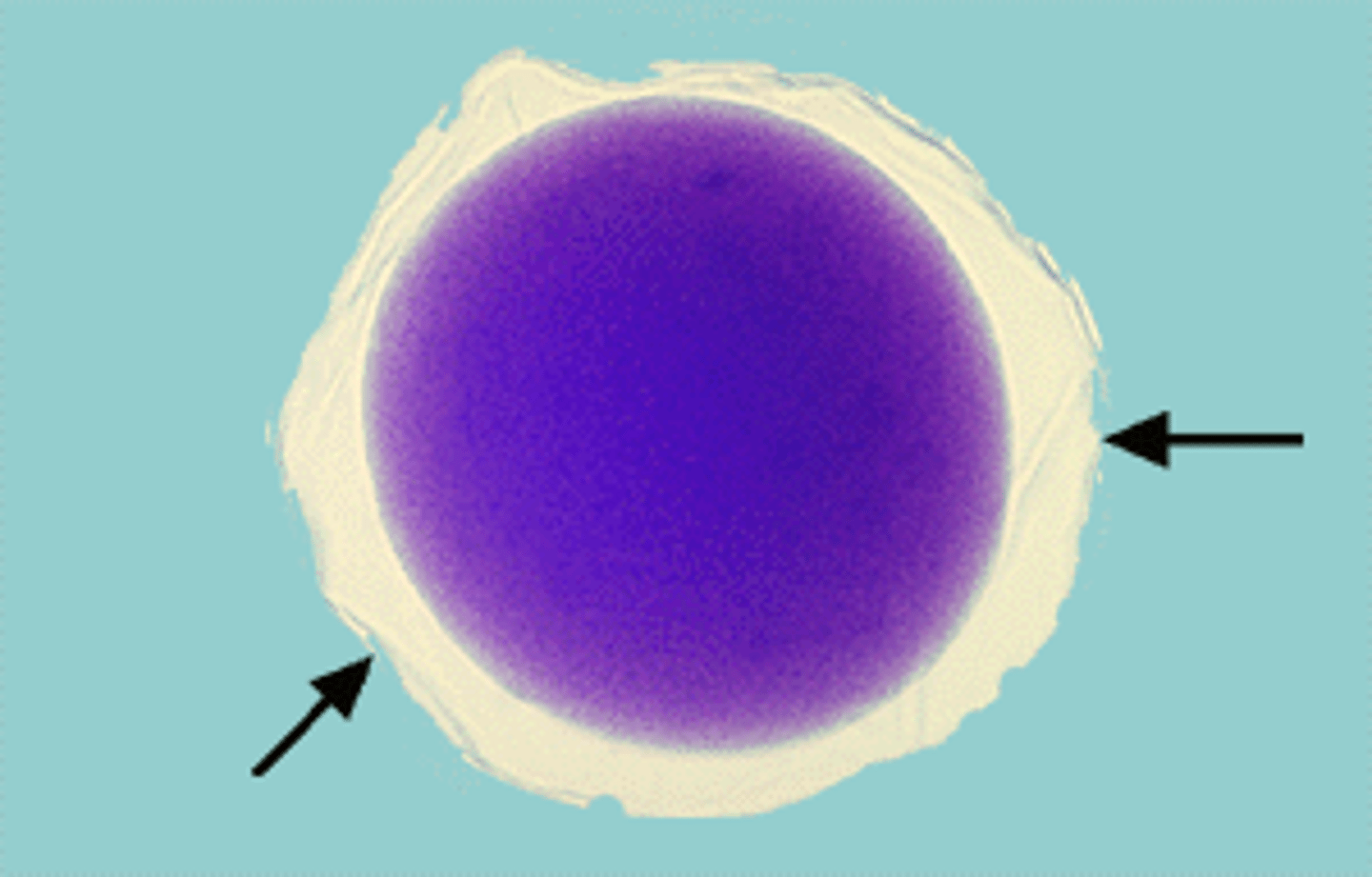 <p>fertilization membrane</p>