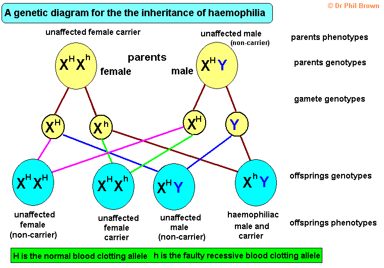 <p>Haemophilia: Condition where blood lacks enough clotting factors <br><strong>3 possible genotypes for females (XX):</strong><br>1. XᴴXᴴ = unaffected (healthy)<br>2. XᴴXʰ = unaffected (healthy) carrier<br>3. Xʰxʰ affected (disease)</p><p><strong>2 possible genotypes for males (XY):</strong><br>1. XᴴY= unaffected (healthy)<br>2. XʰY = affected (disease)</p>