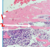 <p>What section of bone is number 2 pointing to?</p>