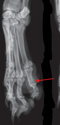 <p>Is located between the Proximal phalanx (the first toe bone connected to the foot) and the middle phalanx (the second toe bone) </p>