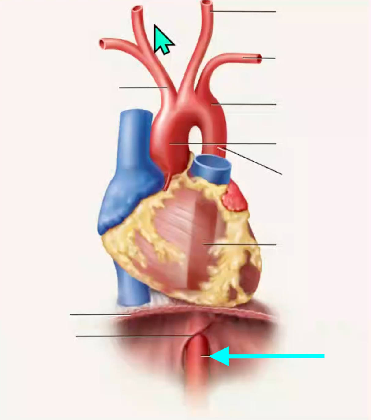 term image