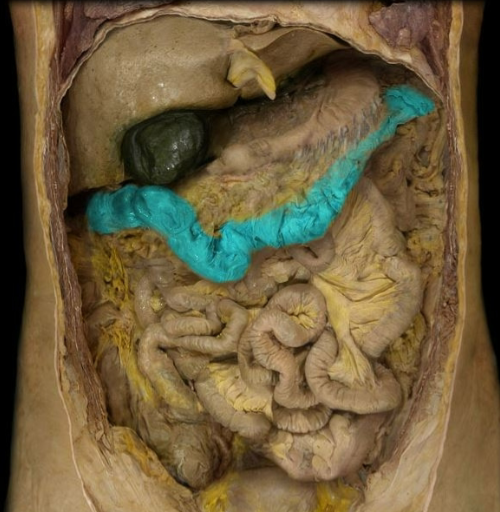 term image