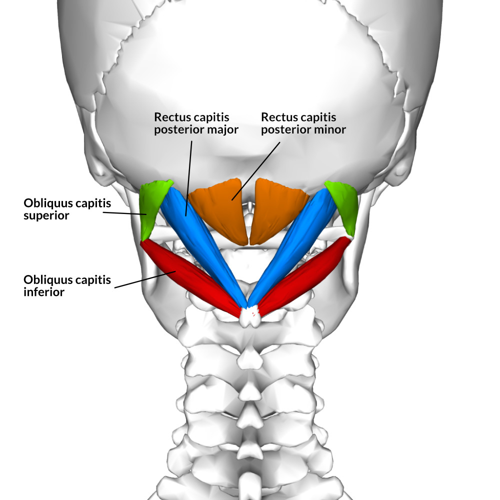 <p>Orange: Rectus capitis posterior minor</p><p>Blue: Rectus Capitis Posterior Major</p><p>Green: Obliquus capitis superior</p><p>Red: Obliquus capitis inferior</p>