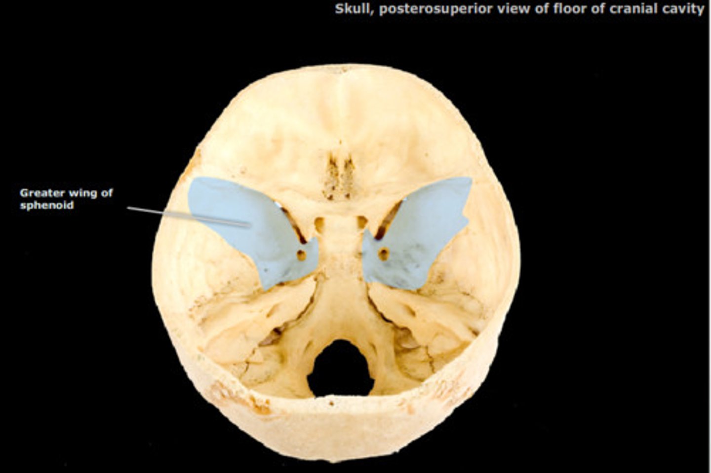 <p>ID part of bone</p>