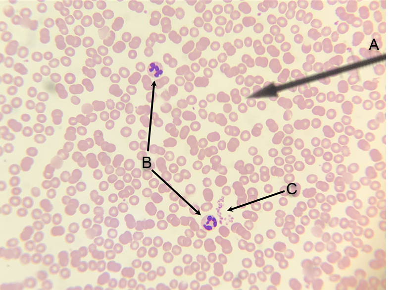<p>I<span>n the image above, identify formed elements A, B, and C.</span></p>