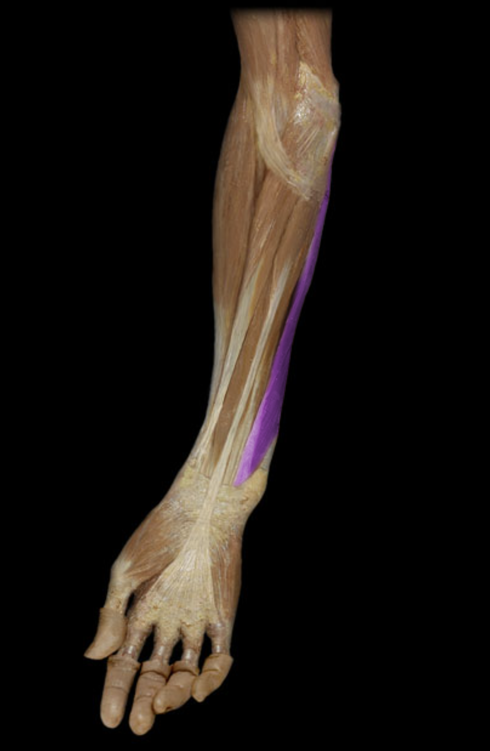 <p>What is the innervation of this muscle?</p>
