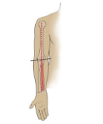 <p>What angle is this within the arm?</p>