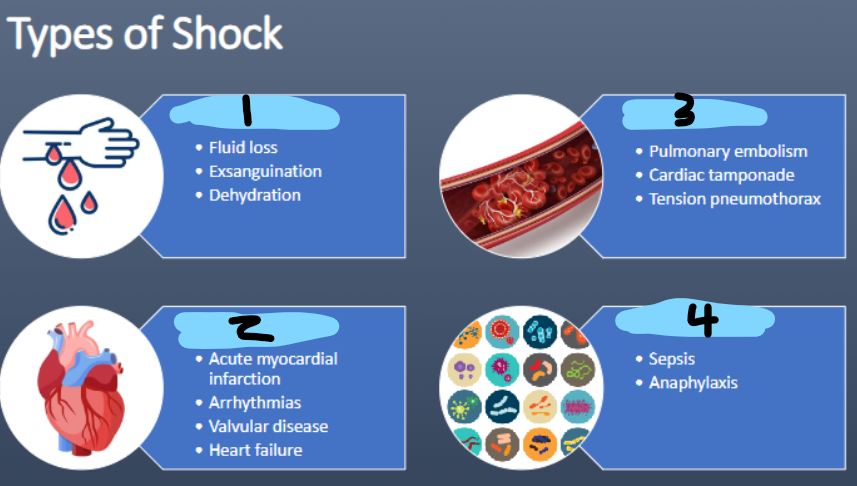 <p>TYPES OF SHOCK → 4</p>