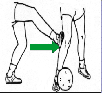 <p>lateral to medial force</p>