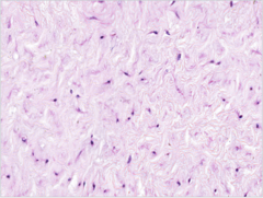 <p>Identify</p>